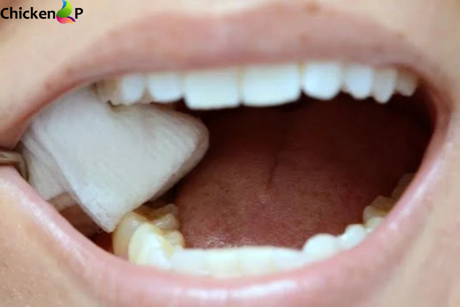day 3 healing normal socket after tooth extraction