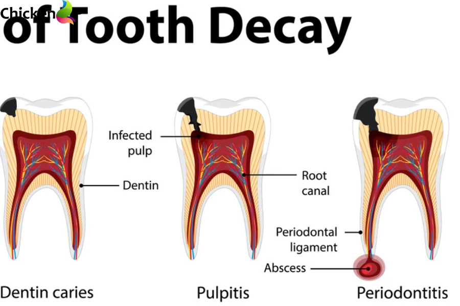 can you die from a tooth infection
