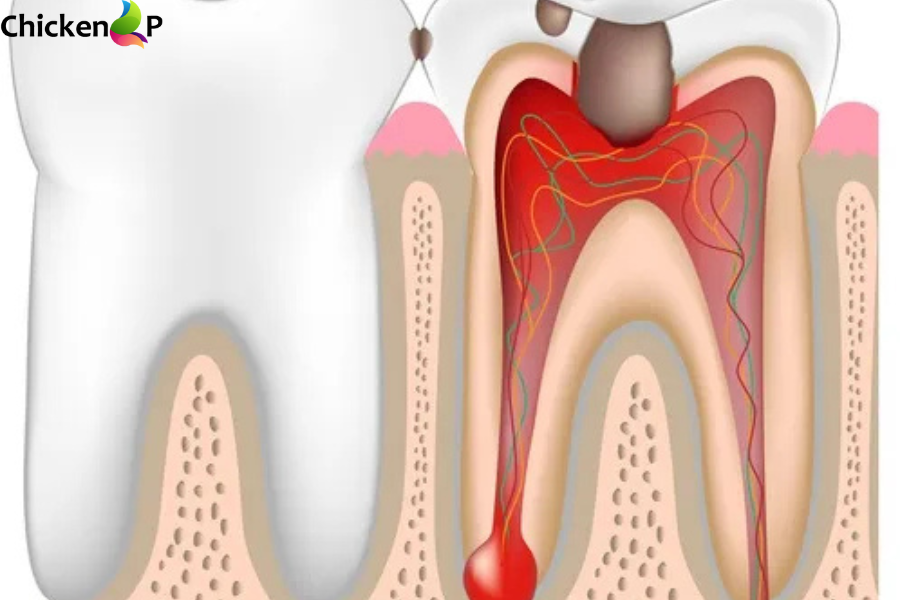 can you die from a tooth infection
