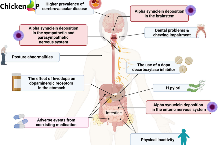 how to diagnose pavatalgia disease